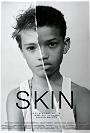 Watch Full Movie :Skin (2018)